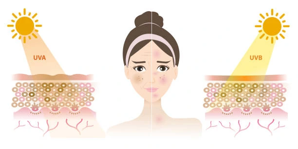 Understanding Sun Damage Wellingborough : How Do UV Rays Cause Changes in the Skin? Wellingborough